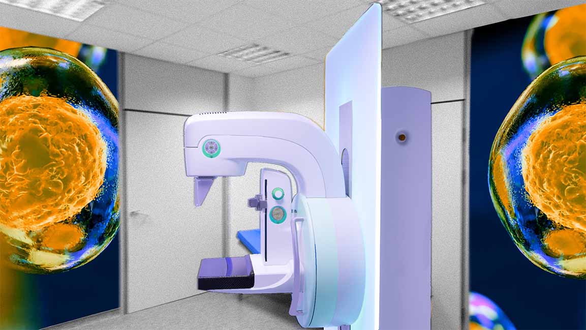 This tech can make breast cancer detection in the Middle East easier and faster