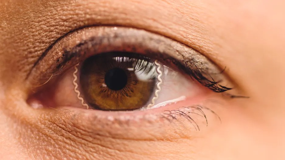 These smart contacts will monitor your eyes 24/7 for glaucoma